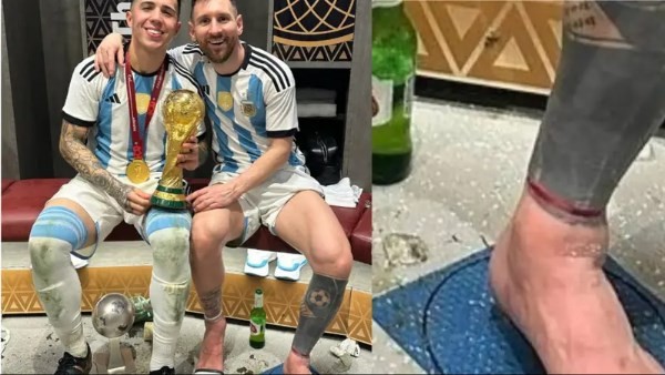 سر السوار الأحمر.. قصة الخيط الذي رافق ميسي في كأس العالم 2026